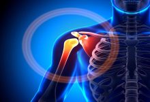 Common Shoulder Injuries And How To Treat